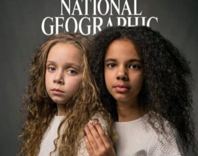 One White And The Other Black: The English Twins Who Challenge Racial Theories