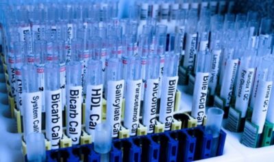 A MOLECULAR LIBRARY AGAINST LUNG CANCER