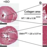 OMA1, The Promising Target For The Treatment Of Heart Failure