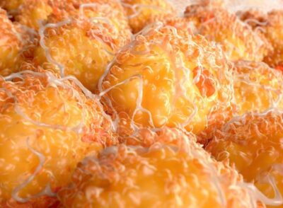 Turn Cancer Cells Into Fat To Prevent Tumors From Excelling