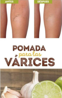 Pomada De Ajo y Limón Para Eliminar Varices y Estrías